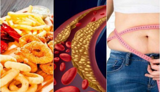 6 yếu tố nguy cơ làm tăng cholesterol máu