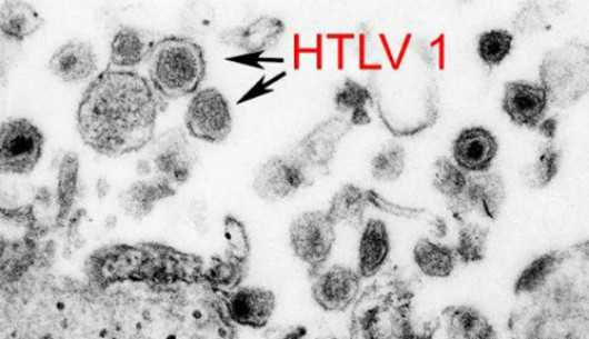 Virus cổ xưa có 'họ hàng với HIV' đột nhiên trỗi dậy