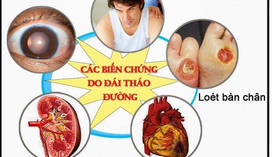 12 biến chứng thầm lặng nhưng nguy hiểm của bệnh đái tháo đường